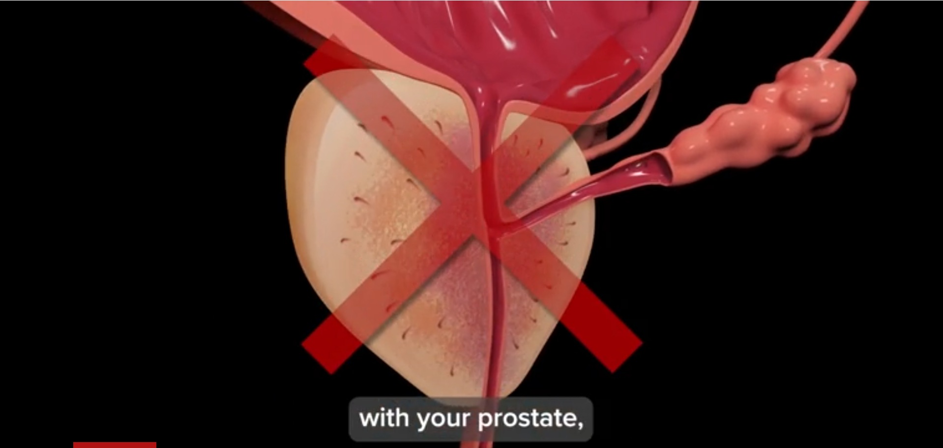 TitanFlow Proizvod
